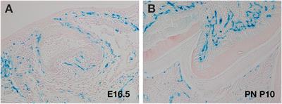 Endothelial cells during craniofacial development: Populating and patterning the head